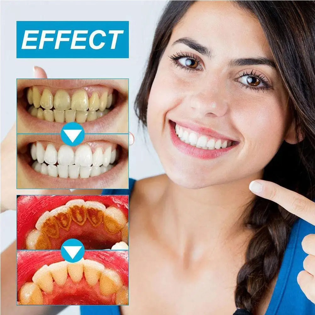MIYANXI Probiotinis balinimas Dėmių šalinimas Dantų pasta Pašviesinti dantis Gaivus kvapas pagerinti geltonus dantis vyrams ir moterims I9F5 Nuotrauka 5